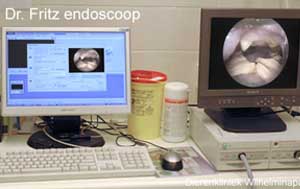 Met onze dr. Fritz endoscoop kunnen we gebitsproblemen in beeld brengen en vastleggen in de computer.